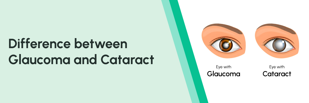 diff between cataract and glaucoma