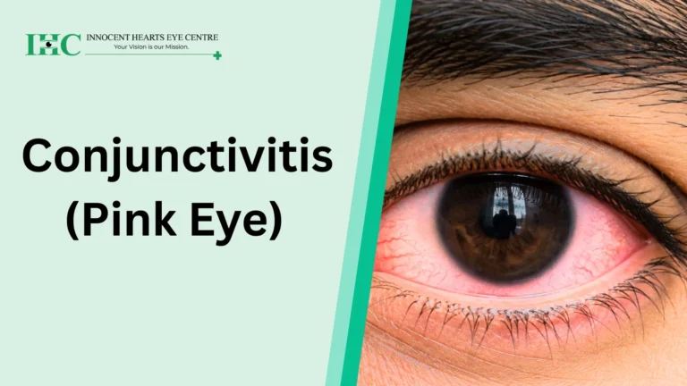 Conjunctivitis (Pink Eye): Meaning, Symptoms, Diagnosis, Treatment