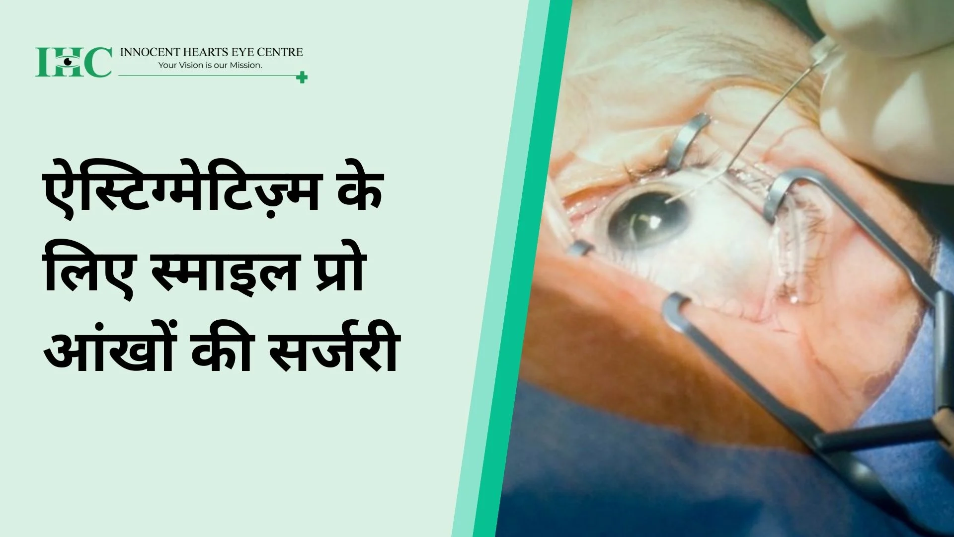 ऐस्टिग्मेटिज़्म के लिए स्माइल प्रो आंखों की सर्जरी