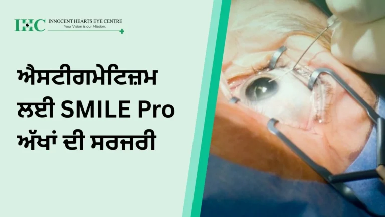 ਐਸਟੀਗਮੇਟਿਜ਼ਮ ਲਈ SMILE Pro ਅੱਖਾਂ ਦੀ ਸਰਜਰੀ