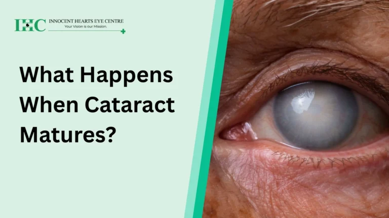 What Happens When Cataract Matures?