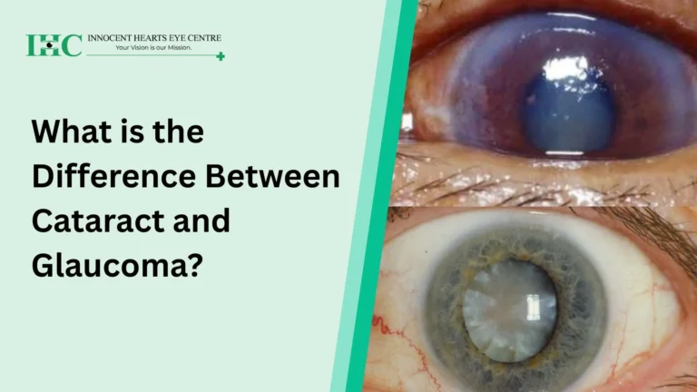 What is the Difference Between Cataract and Glaucoma?