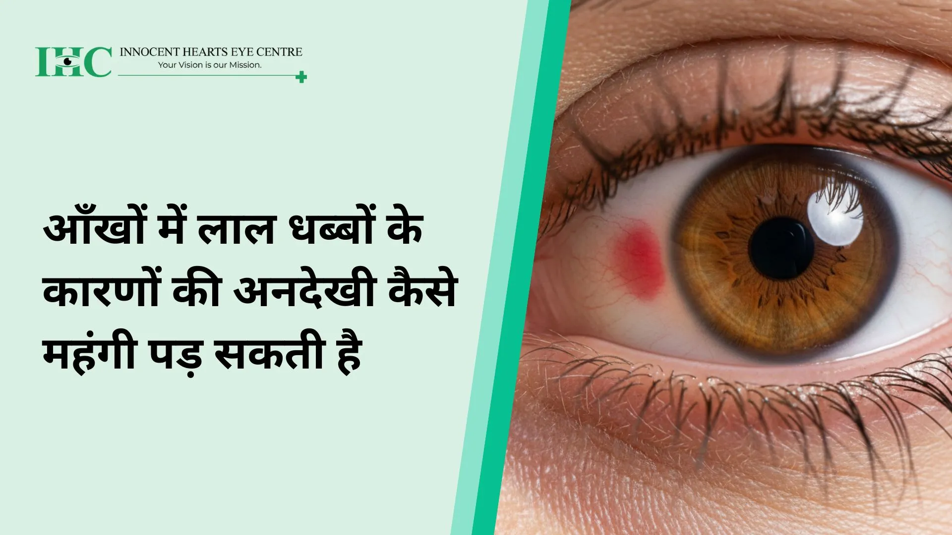आँखों में लाल धब्बों के कारणों की अनदेखी कैसे महंगी पड़ सकती है