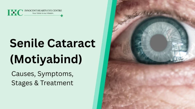 Senile Cataract (Motiyabind): Causes, Symptoms, Stages & Treatment